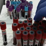 Spitalul Județean oferă analize medicale gratuite